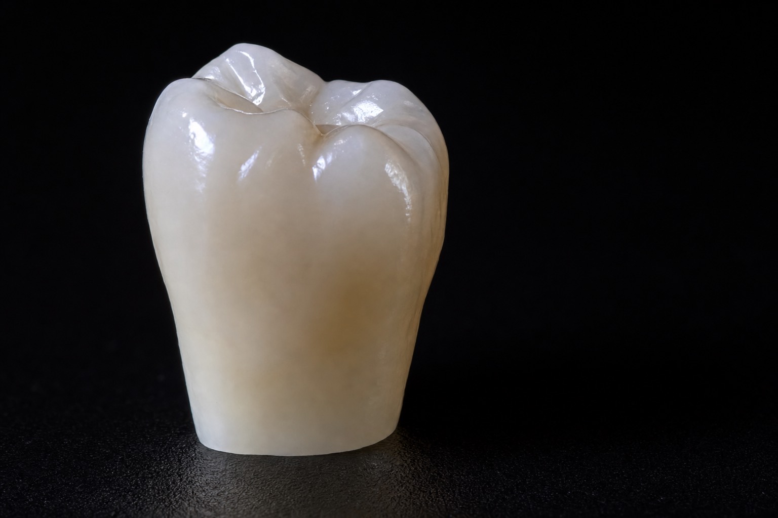 A finished all-ceramic porcelain crown